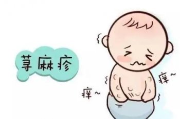 荨麻疹反复发作怎么办？