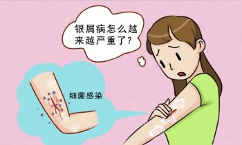 南京银屑病研究所可靠吗？