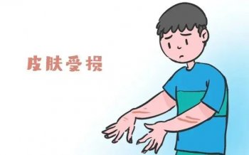 南京银屑病专科医院地址