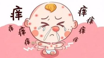 湿疹止痒怎么治疗